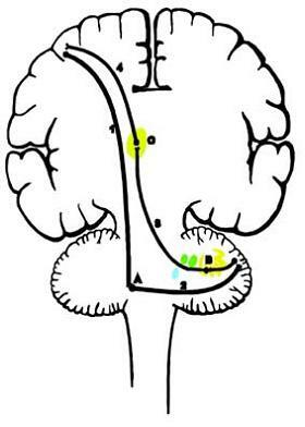 Dentatothalamic Tract