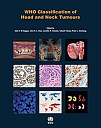 Who Classification of Head and Neck Tumours (Paperback, 4)
