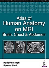 Atlas of Human Anatomy on MRI: Brain, Chest & Abdomen (Paperback)