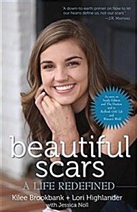 Beautiful Scars: A Life Redefined (Paperback)