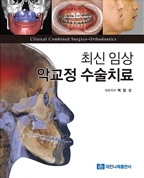 최신 임상 악교정 수술치료