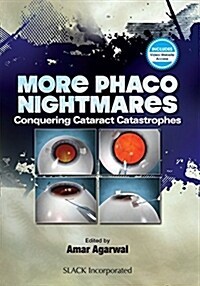 More Phaco Nightmares: Conquering Cataract Catastrophes (Hardcover)