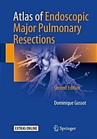 Atlas of Endoscopic Major Pulmonary Resections (Paperback, 2, 2018)
