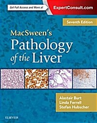 MacSweens Pathology of the Liver (Hardcover, 7 ed)