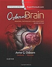 Osborns Brain (Hardcover)