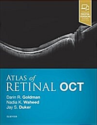 Atlas of Retinal Oct: Optical Coherence Tomography (Hardcover)