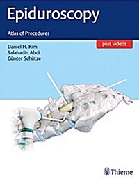 Epiduroscopy: Atlas of Procedures (Hardcover)