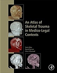 An Atlas of Skeletal Trauma in Medico-legal Contexts (Hardcover)