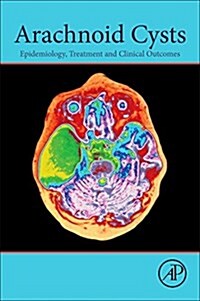 Arachnoid Cysts: Epidemiology, Biology, and Neuroimaging (Paperback)