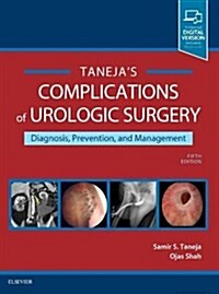 Complications of Urologic Surgery: Prevention and Management (Hardcover, 5)