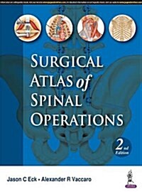 Surgical Atlas of Spinal Operations (Hardcover, 2)