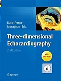Three-Dimensional Echocardiography (Paperback, 2, Softcover Repri)
