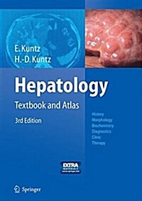 Hepatology: Textbook and Atlas (Paperback, 3, Softcover Repri)