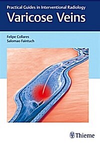 Varicose Veins: Practical Guides in Interventional Radiology (Hardcover)