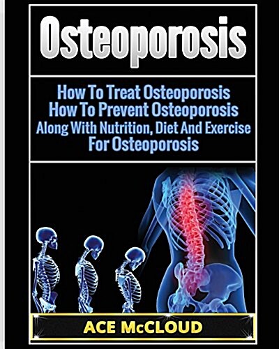 Osteoporosis: How to Treat Osteoporosis: How to Prevent Osteoporosis: Along with Nutrition, Diet and Exercise for Osteoporosis (Paperback)