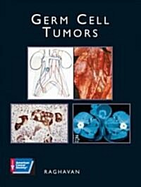 Germ Cell Tumors [With CDROM] (Hardcover)
