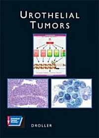 Urothelial Tumors [With CDROM] (Hardcover)