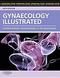 Gynaecology Illustrated (Paperback, 6 International ed)