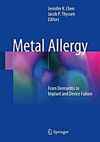 Metal Allergy: From Dermatitis to Implant and Device Failure (Hardcover, 2018)