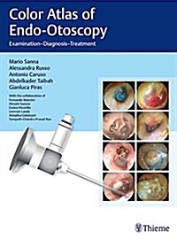 Color Atlas of Endo-Otoscopy: Examination - Diagnosis - Treatment (Hardcover)
