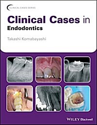 Clinical Cases in Endodontics (Paperback)