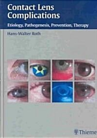 Contact Lens Complications (Hardcover)