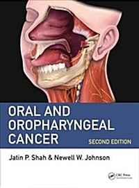 [중고] Oral and Oropharyngeal Cancer (Hardcover, 2)
