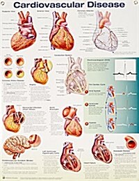 Cardiovascular Disease (Poster, 3 Rev ed)