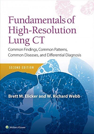 Fundamentals of High-Resolution Lung CT: Common Findings, Common Patterns, Common Diseases and Differential Diagnosis (Paperback, 2)