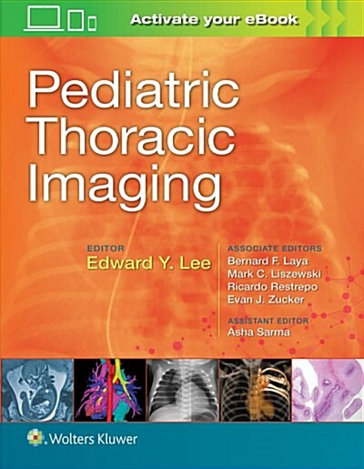 Pediatric Thoracic Imaging (Hardcover)