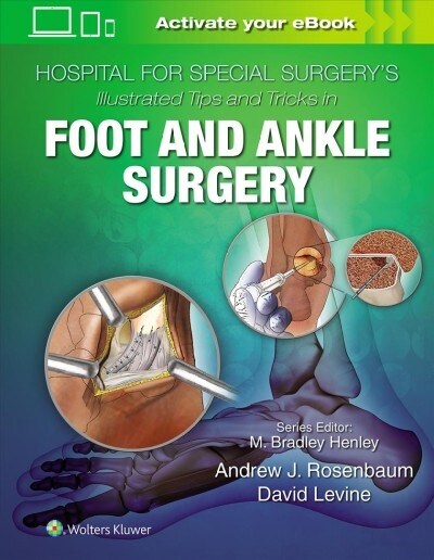 Hospital for Special Surgerys Illustrated Tips and Tricks in Foot and Ankle Surgery (Hardcover)