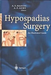 Hypospadias Surgery: An Illustrated Guide (Hardcover)