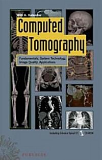 Computed Tomography (Hardcover, CD-ROM, 2nd)