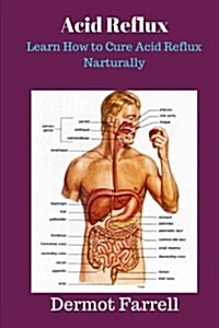 Acid Reflux: Learn How to Cure Acid Reflux Naturally (Paperback)