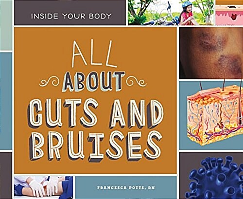 All about Cuts and Bruises (Library Binding)