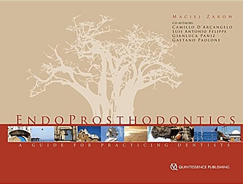 Endoprosthodontics (Hardcover)