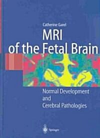 MRI of the Fetal Brain: Normal Development and Cerebral Pathologies (Hardcover)
