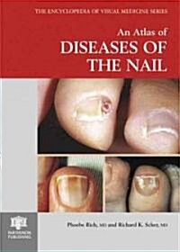 An Atlas of Diseases of the Nail (Hardcover, Twenty-Third)