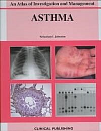 Asthma : An Atlas of Investigation and Diagnosis (Hardcover)