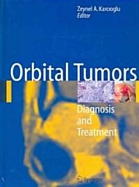 Orbital Tumors: Diagnosis and Treatment (Hardcover)
