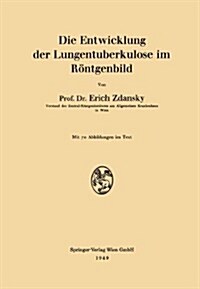 Die Entwicklung Der Lungentuberkulose Im R?tgenbild (Paperback, 1949)