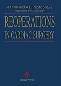 Reoperations in Cardiac Surgery (Hardcover)