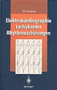 Elektrokardiographie Tachykarder Rhythmusstarungen (Hardcover)