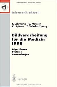 Bildverarbeitung F? Die Medizin 1998: Algorithmen -- Systeme -- Anwendungen Proceedings Des Workshops Am 26. Und 27. M?z 1998 in Aachen (Paperback)