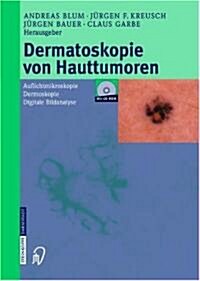Dermatoskopie Von Hauttumoren: Auflichtmikroskopie - Dermoskopie - Digitale Bildanalyse (Hardcover)