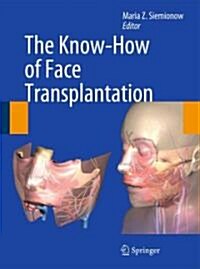 The Know-How of Face Transplantation (Hardcover)