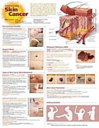 Understanding Skin Cancer Anatomical Chart (Hardcover, 2)