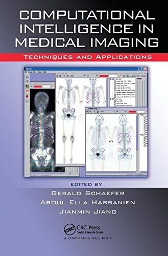 Computational Intelligence in Medical Imaging : Techniques and Applications (Paperback)