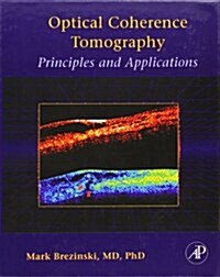 Optical Coherence Tomography: Principles and Applications (Hardcover)