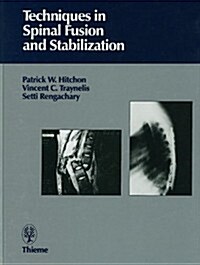 Techniques in Spinal Fusion and Stabilization: (Hardcover)